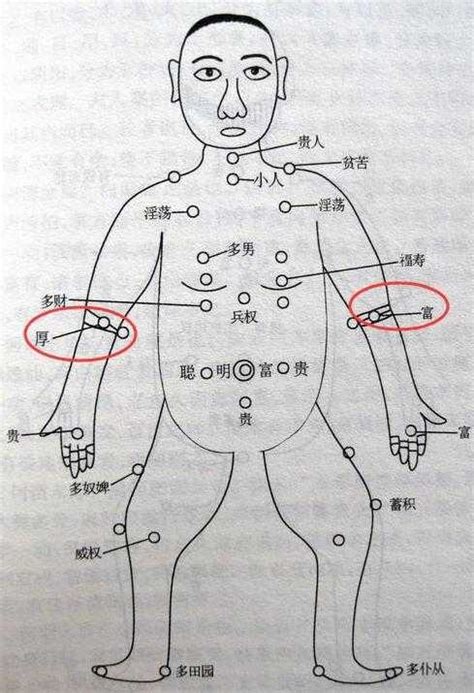 身體:acsf1ltef_m= 痣的位置|我的「痣」會是惡性腫瘤嗎？醫師告訴你：符合這5特徵，一定要。